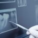 Dental x-ray